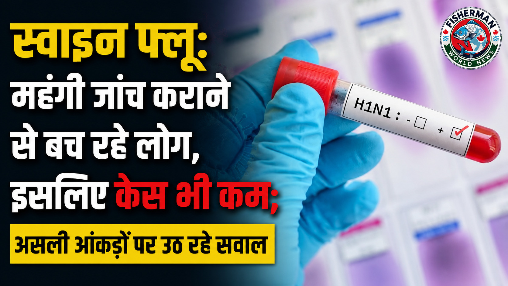 Lucknow Swine Flu